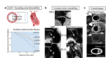 Circle Cardiovascular Imaging CVI42