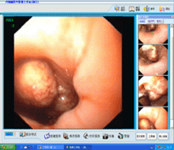 腹腔镜工作站软件